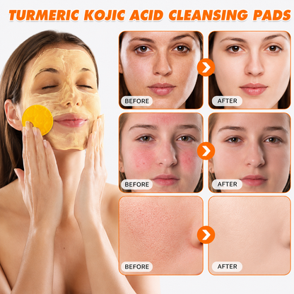 Prionne Turmeric Kojic Glow Pads