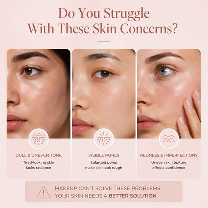 Covers redness — without the cakey foundation look.