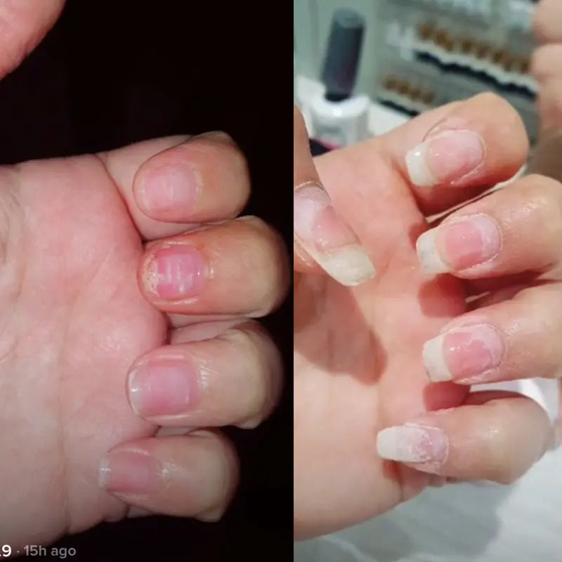 AuraWhispers 100% Organic Nail Growth Oil, Enriched with Vitamins & Fatty Acids to Nourish, Strengthen and Brighten Nails