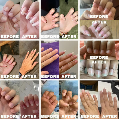AuraWhispers 100% Organic Nail Growth Oil, Enriched with Vitamins & Fatty Acids to Nourish, Strengthen and Brighten Nails