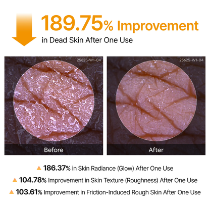 AuraWhispers Keratin Care Kojic Acid Turmeric Spray